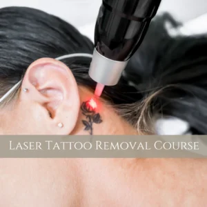 laser tattoo removal course