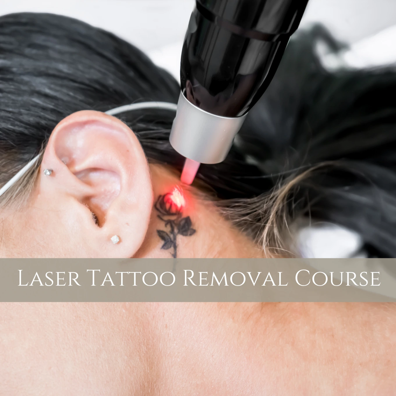 laser tattoo removal course