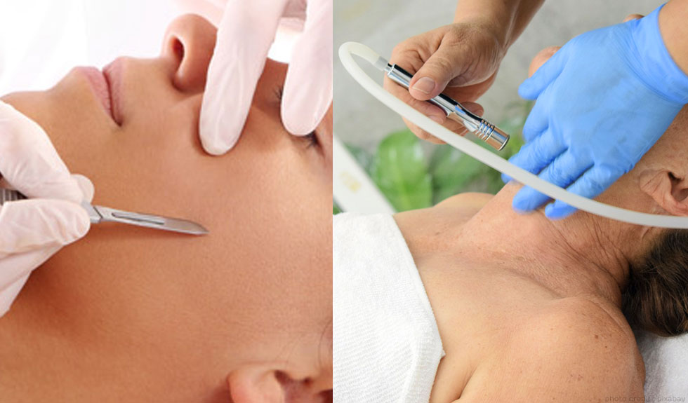 Dermaplaning vs Microdermabrasion