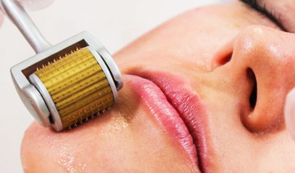 microneediling